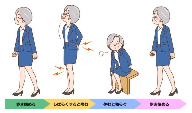 症状経過イメージ